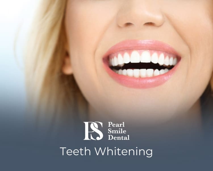teeth whitening didsbury